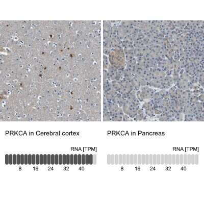 Immunohistochemistry-Paraffin: PKC alpha Antibody [NBP1-87268]