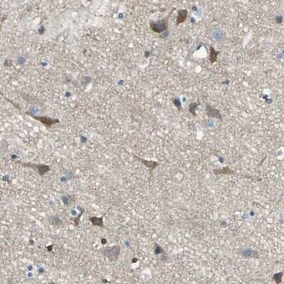 Immunohistochemistry-Paraffin: PKC alpha Antibody [NBP1-87269]