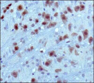 Immunohistochemistry: PKC alpha Antibody (MC5) - Azide and BSA Free [NBP2-80911]