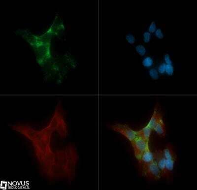 Immunocytochemistry/ Immunofluorescence: PKC alpha Antibody (MC5) [NB600-201]