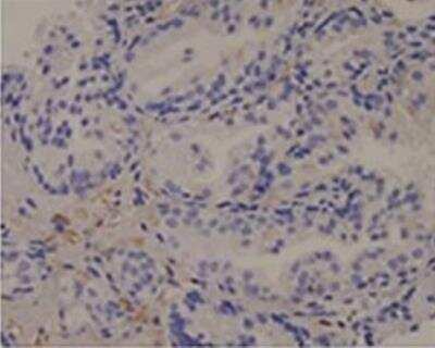 Immunohistochemistry-Paraffin: PKC alpha Antibody (MC5) [NB600-201]