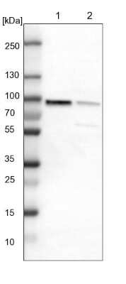 Western Blot: PKC alpha Antibody [NBP1-87268]