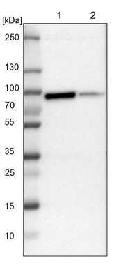 Western Blot: PKC alpha Antibody [NBP1-87269]