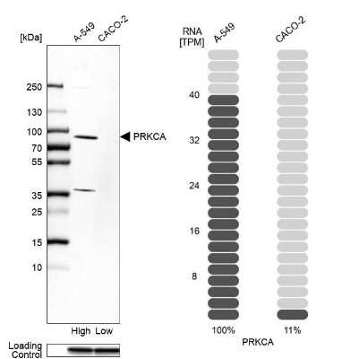 Western Blot: PKC alpha Antibody [NBP1-87269]