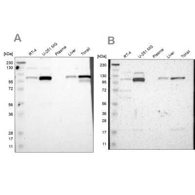 Western Blot: PKC alpha Antibody [NBP1-87269]