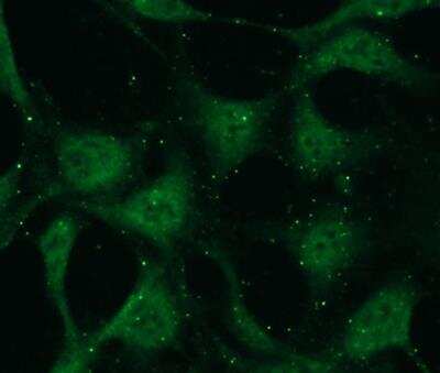 Immunocytochemistry/ Immunofluorescence: PKC beta 2 Antibody (N11-S) [NBP3-08202]