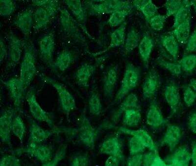 Immunocytochemistry/ Immunofluorescence: PKC beta 2 Antibody (N11-S) [NBP3-08202]