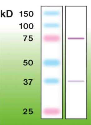 Western Blot: PKC beta 2 Antibody (N11-S) [NBP3-08202]