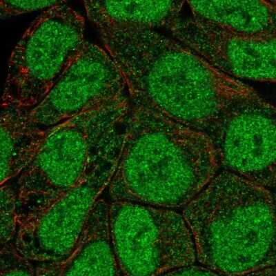 Immunocytochemistry/ Immunofluorescence: PKC beta Antibody [NBP2-38579]