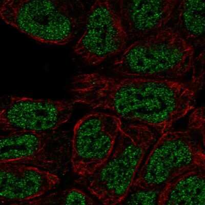 Immunocytochemistry/ Immunofluorescence: PKC beta Antibody [NBP2-54928]