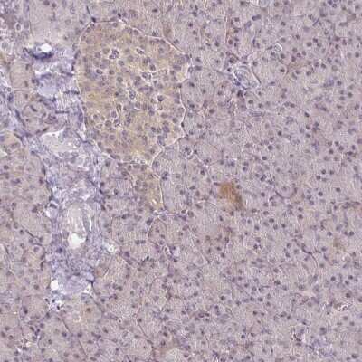 Immunohistochemistry: PKC beta Antibody [NBP2-38579]