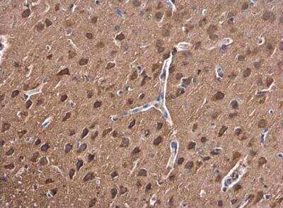 Immunohistochemistry-Paraffin: PKC beta Antibody [NBP2-19846]