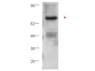 Western Blot: PKC beta Antibody [NB110-86972]