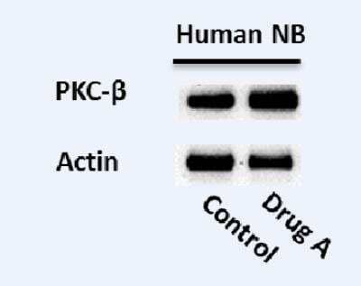 Western Blot: PKC beta Antibody [NBP2-19846]