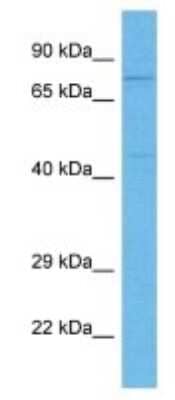 Western Blot: PKC beta Antibody [NBP3-09962]