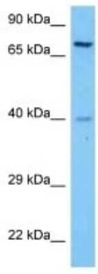 Western Blot: PKC beta Antibody [NBP3-10285]