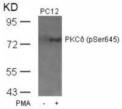 Western Blot: PKC delta [p Ser645] Antibody [NB100-82141]
