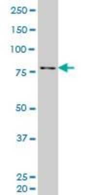 Western Blot: PKC delta Antibody (2E12) [H00005580-M06]