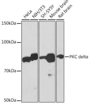 Western Blot: PKC delta Antibody (7I5U6) [NBP3-16660]