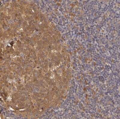 Immunohistochemistry: PKC delta Antibody [NBP1-90957]