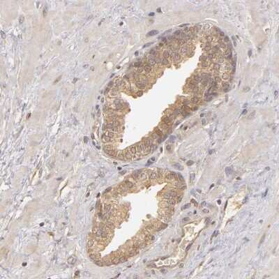 Immunohistochemistry-Paraffin: PKC delta Antibody [NBP1-90957]