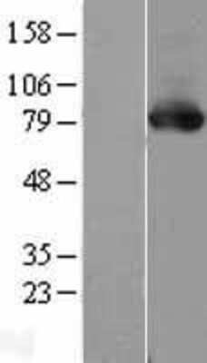 Western Blot: PKC delta Overexpression Lysate [NBL1-14771]