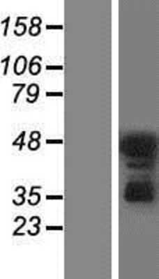 Western Blot: PKC delta Overexpression Lysate [NBP2-11306]