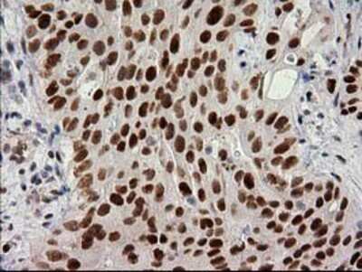 Immunohistochemistry-Paraffin: PKC epsilon Antibody (OTI4G8) [NBP2-03620]