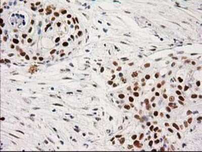 Immunohistochemistry-Paraffin: PKC epsilon Antibody (OTI4G8) [NBP2-03620]