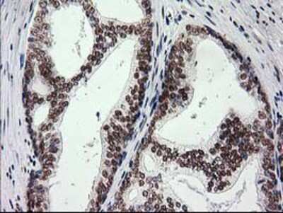 Immunohistochemistry-Paraffin: PKC epsilon Antibody (OTI4G8) [NBP2-03620]