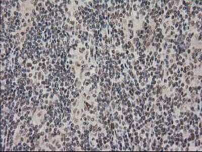 Immunohistochemistry-Paraffin: PKC epsilon Antibody (OTI4G8) [NBP2-03620]