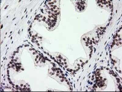 Immunohistochemistry-Paraffin: PKC epsilon Antibody (OTI4G8) [NBP2-03620]