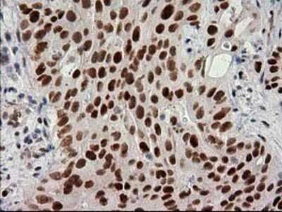 Immunohistochemistry: PKC epsilon Antibody (OTI4G8) - Azide and BSA Free [NBP2-73438]