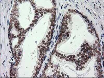 Immunohistochemistry: PKC epsilon Antibody (OTI4G8) - Azide and BSA Free [NBP2-73438]