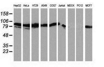 Western Blot: PKC epsilon Antibody (OTI4G8)Azide and BSA Free [NBP2-73438]