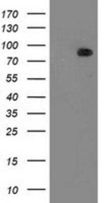 Western Blot: PKC epsilon Antibody (OTI4G8)Azide and BSA Free [NBP2-73438]