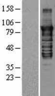 Western Blot: PKC epsilon Overexpression Lysate [NBL1-14774]