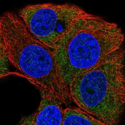 Immunocytochemistry/ Immunofluorescence: PKC eta Antibody [NBP2-38711]