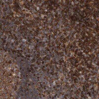 Immunohistochemistry: PKC eta Antibody [NBP1-80899]