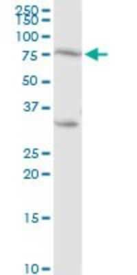 Western Blot: PKC eta Antibody [H00005583-D01P]