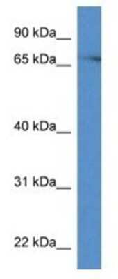 Western Blot: PKC eta Antibody [NBP1-74117]