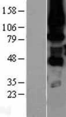 Western Blot: PKC eta Overexpression Lysate [NBL1-14776]