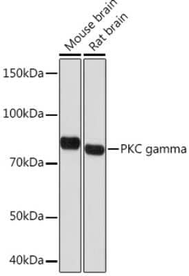 Western Blot: PKC gamma Antibody (5F2X3) [NBP3-16611]