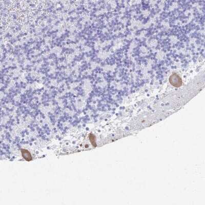 Immunohistochemistry: PKC gamma Antibody [NBP2-38569]