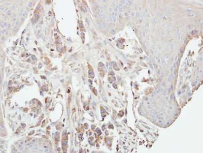 Immunohistochemistry-Paraffin: PKC gamma Antibody [NBP1-32535]