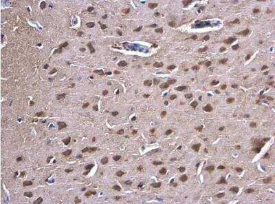 Immunohistochemistry-Paraffin: PKC gamma Antibody [NBP1-32535]