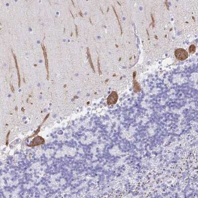 Immunohistochemistry-Paraffin: PKC gamma Antibody [NBP2-38728]