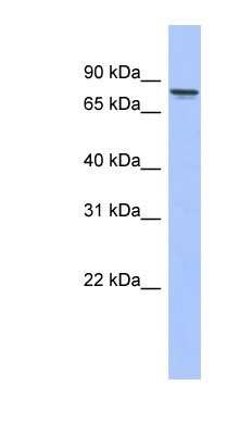 Western Blot: PKC gamma Antibody [NBP1-58916]