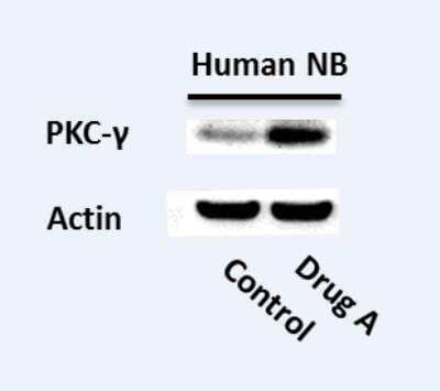 Western Blot: PKC gamma Antibody [NBP1-58916]