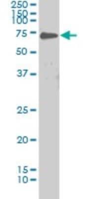 Western Blot: PKC iota Antibody (1A10) [H00005584-M03]